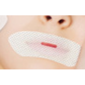 Mouth stickers